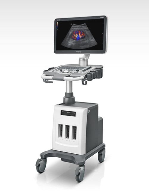 Mindray DC-30 Ultrasound Machine – Diagnostic Imaging System
