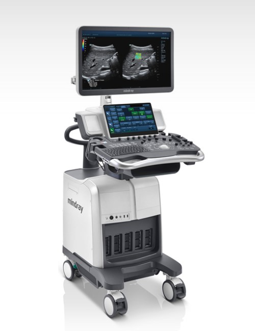 Mindray DC-80 Ultrasound Machine – High-End Radiology Equipment India