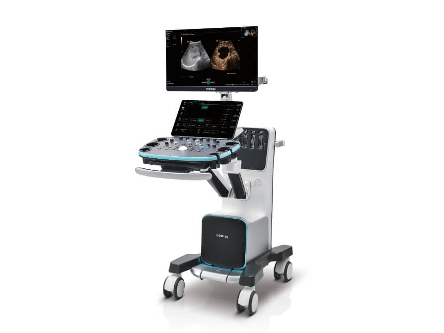Resona I9 Ultrasound – Innovative Diagnostic Solution