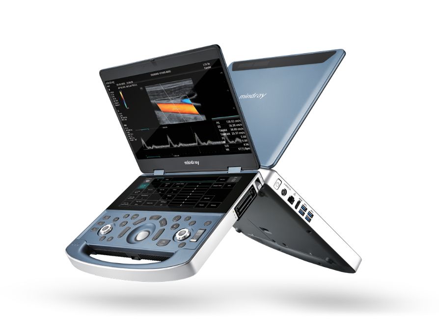 MX7 Dedicated Portable Ultrasound System