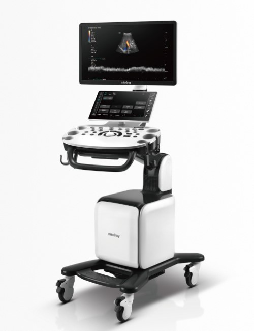 Consona N6 Ultrasound – Innovative Medical Imaging System