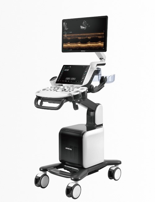 Consona N7 Ultrasound – Premium Imaging System