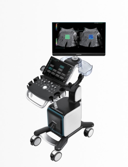 Consona N9 Ultrasound – Next-Gen Medical Imaging Solution